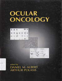 Image of Ocular Oncology